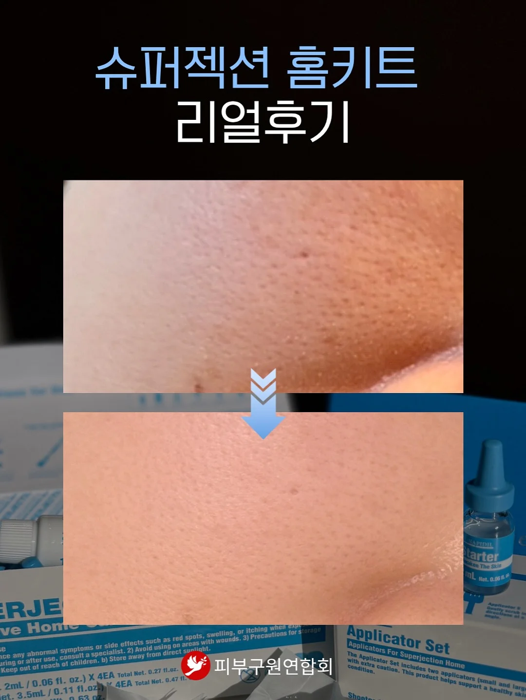 실루엣 중심 후들거리는 쉬어한 소재 의류 8