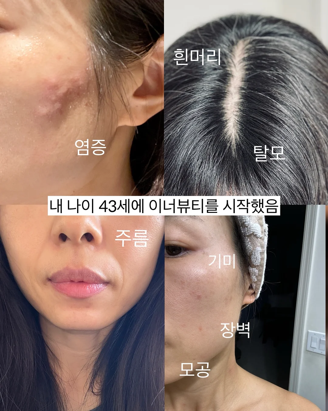 풍선 장식 출장 세팅 5