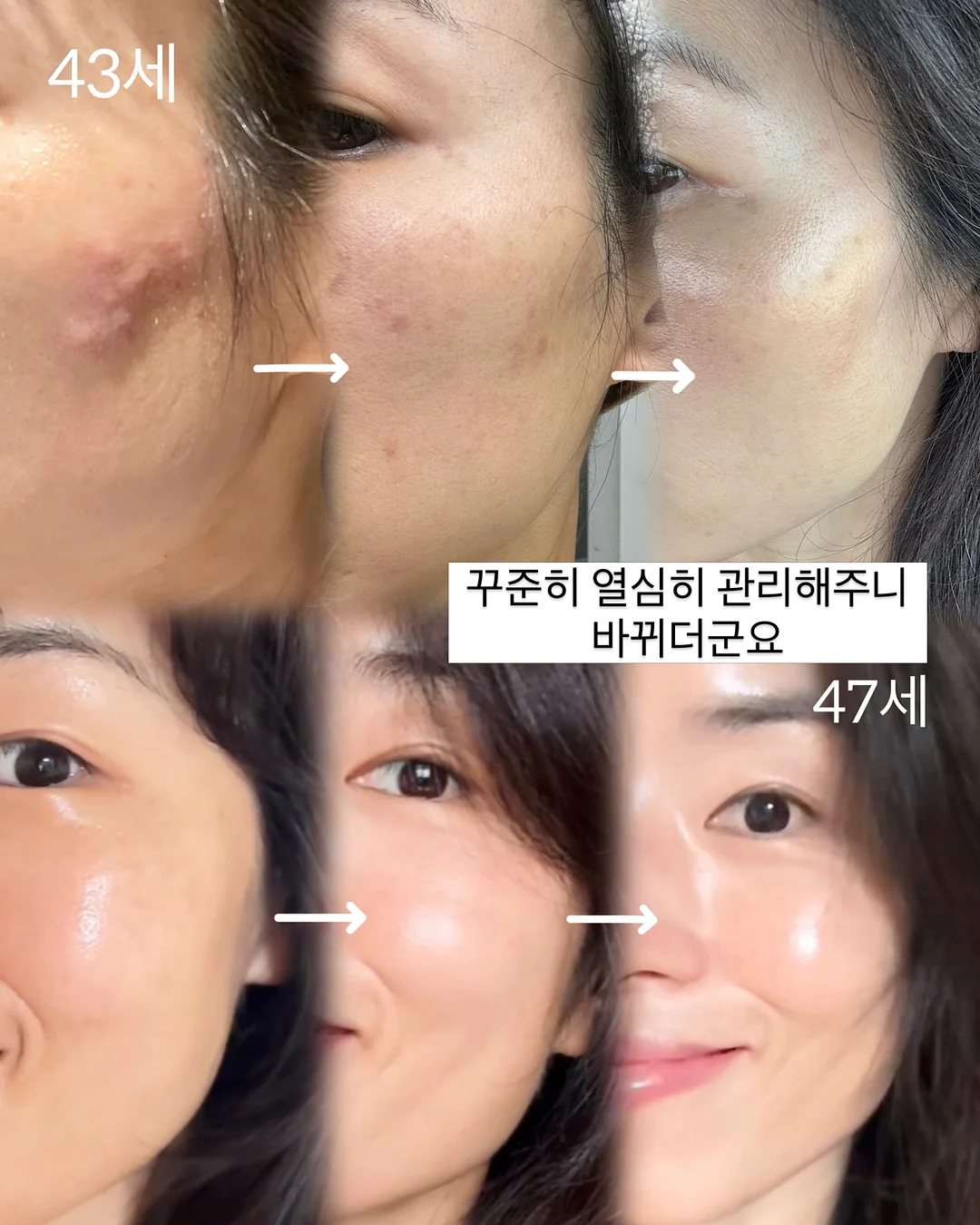 풍선 장식 출장 세팅 7