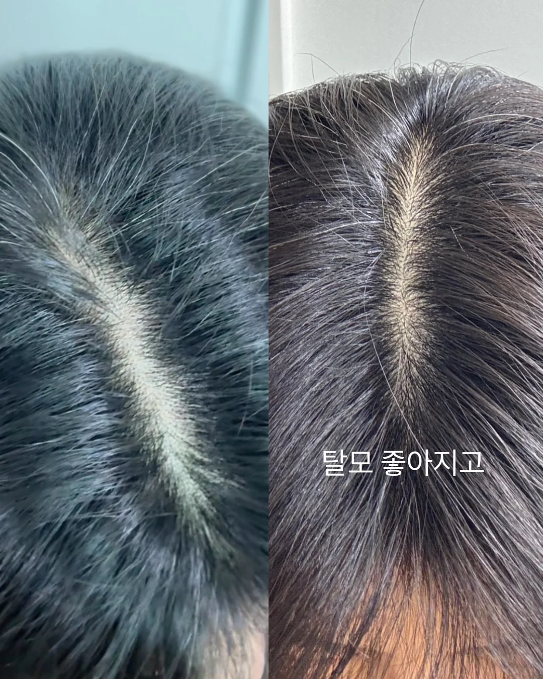 풍선 장식 출장 세팅 10