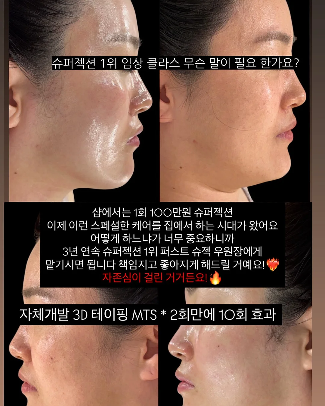 커스텀 마스킹테이프 10
