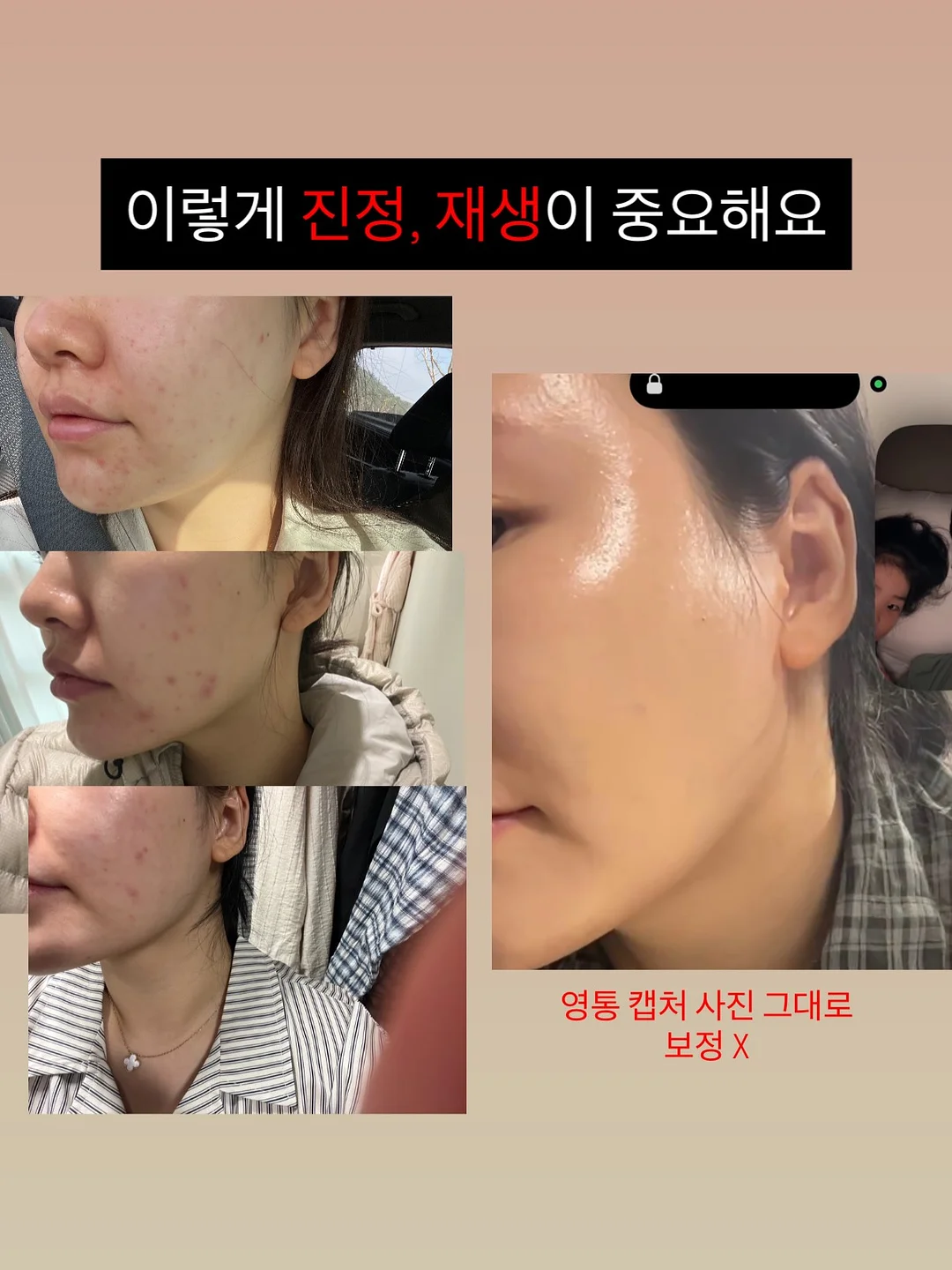 자동 잔수배출 무독성 실리콘 샤워호스 1