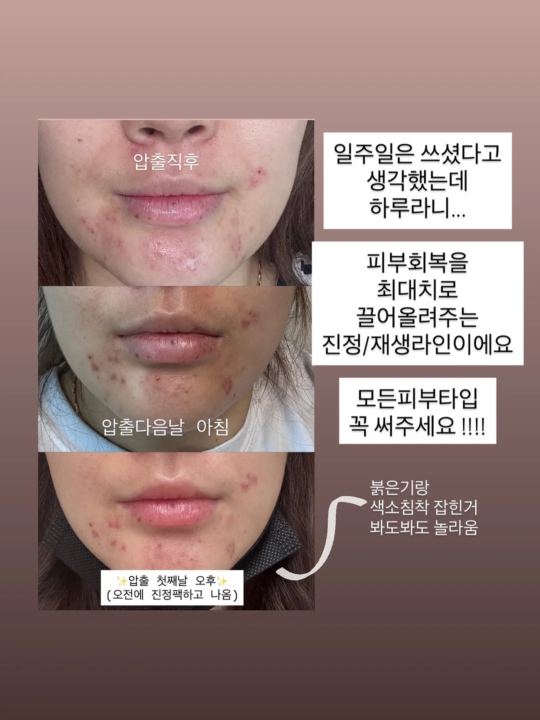 자동 잔수배출 무독성 실리콘 샤워호스 4