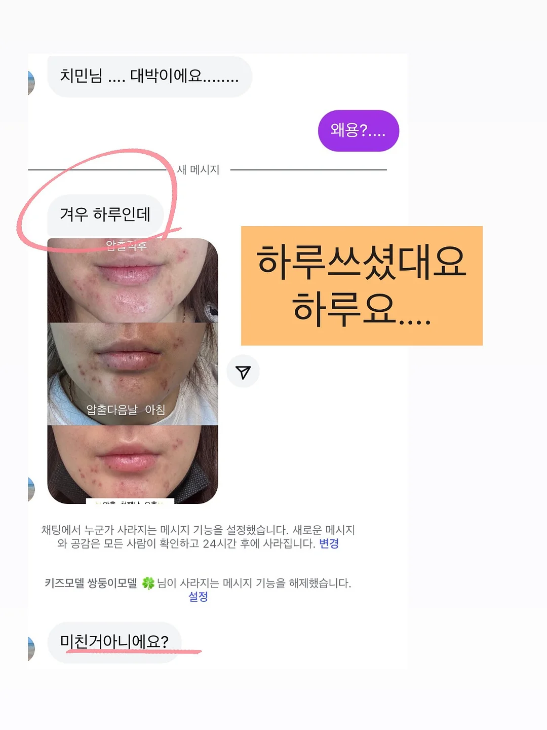 자동 잔수배출 무독성 실리콘 샤워호스 5