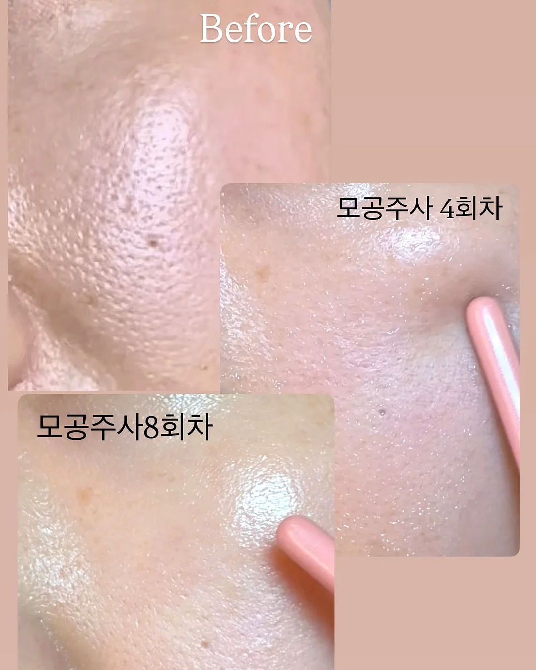 트랙터 11