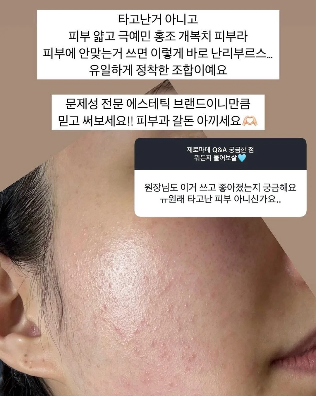 한우 대창 전골 7