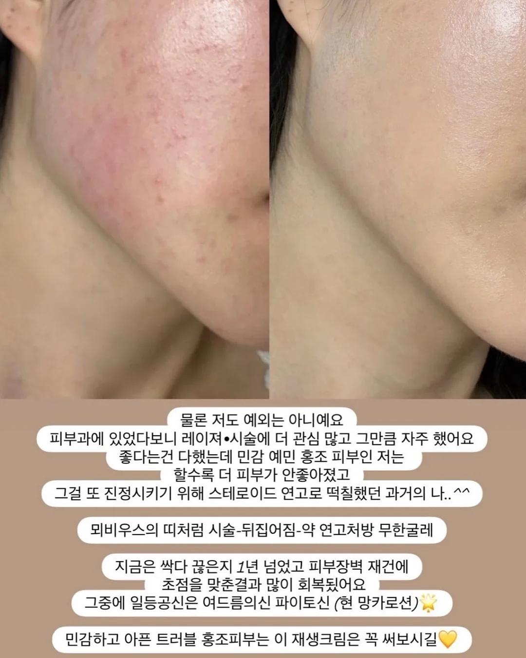 한우 대창 전골 8