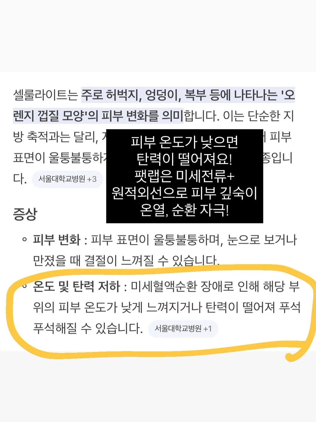 버섯 치킨 11