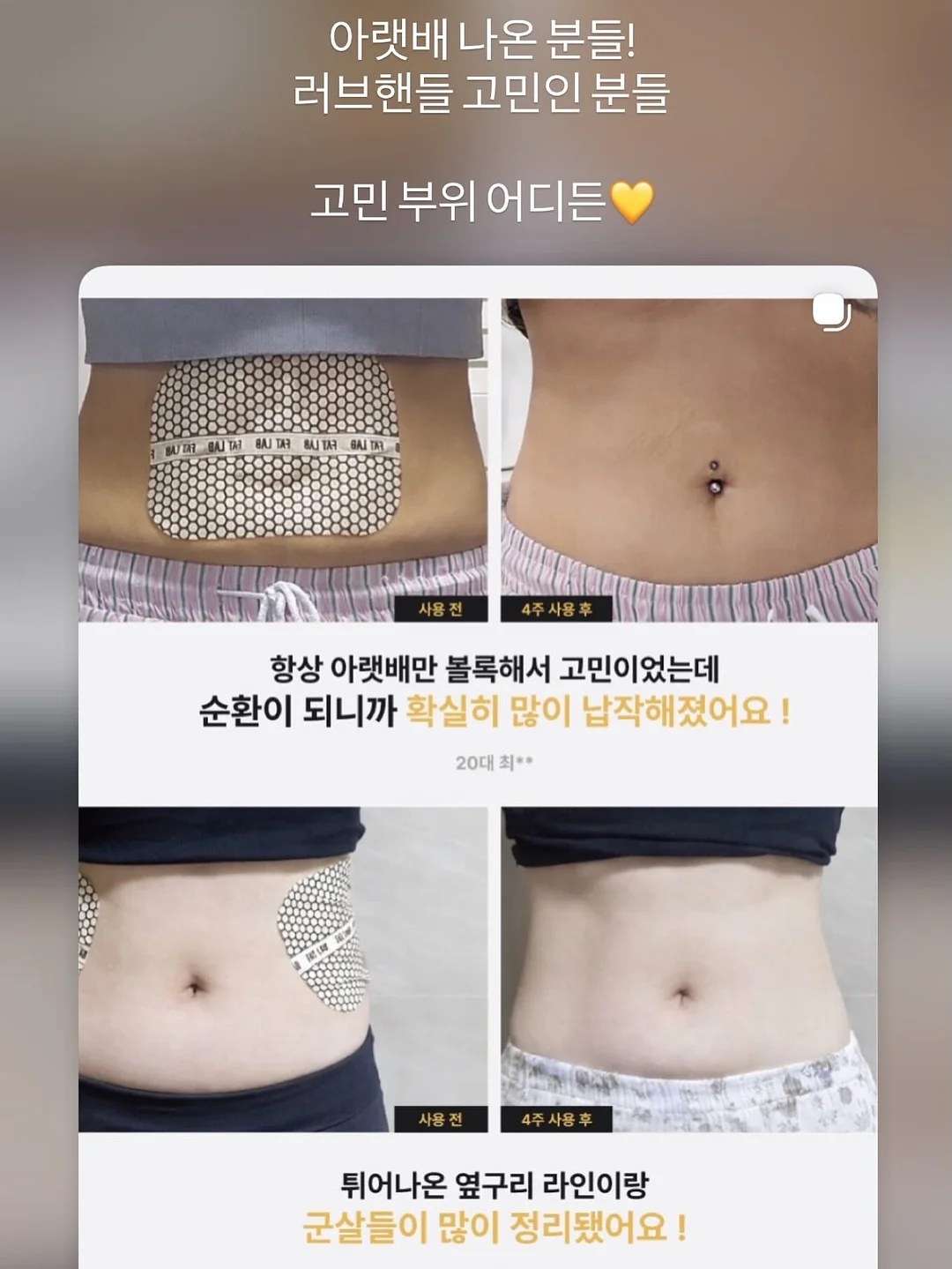 버섯 치킨 12