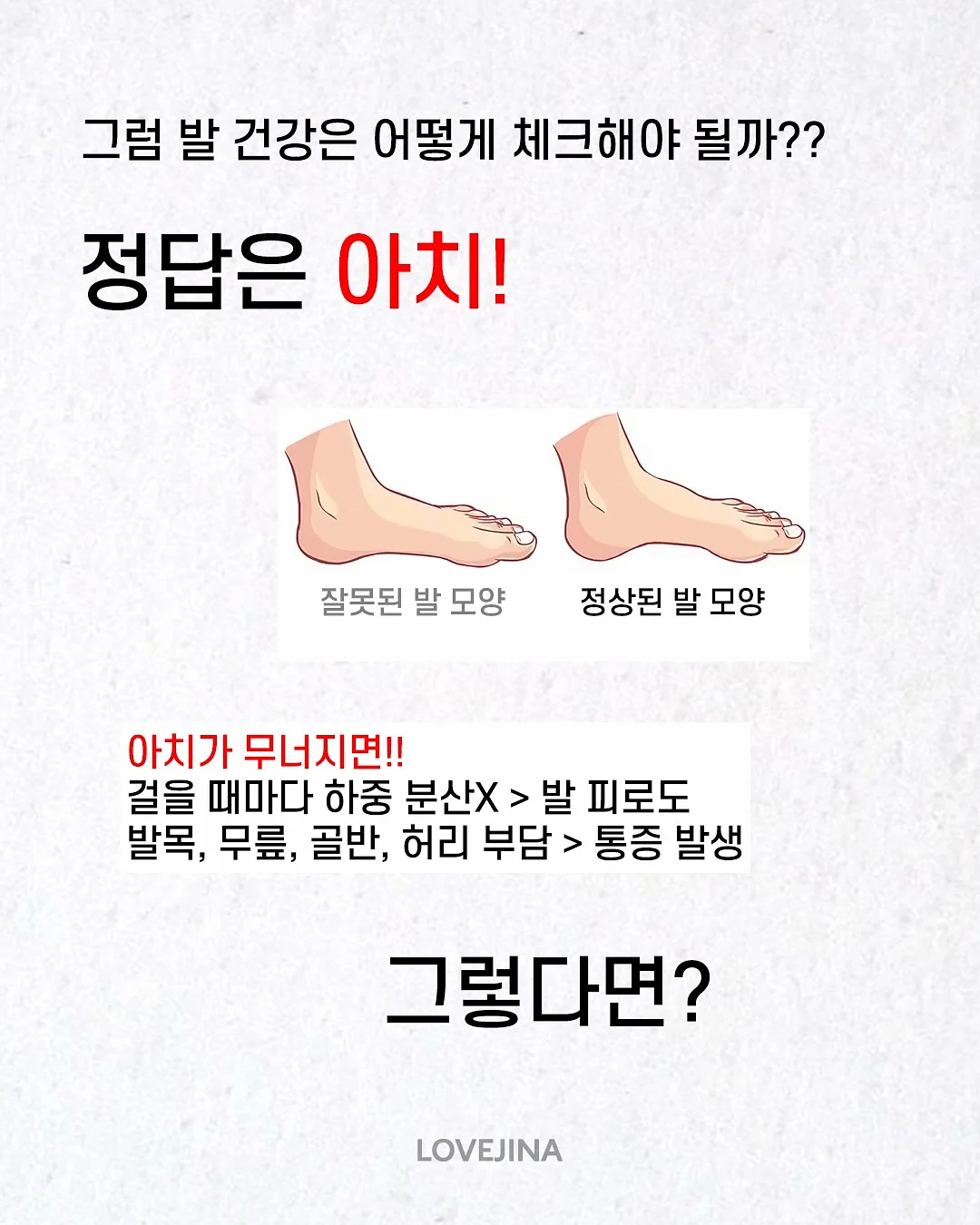 슈퍼젝션 관리 10
