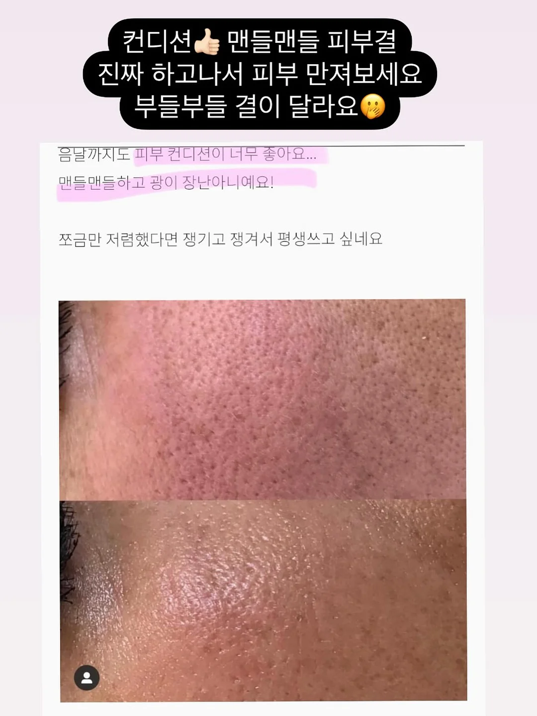 슈혼 구둣주걱 12