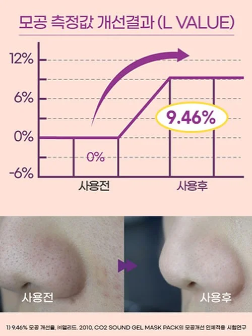 슈혼 구둣주걱 16