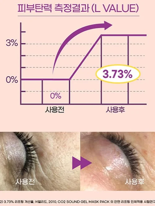 슈혼 구둣주걱 17