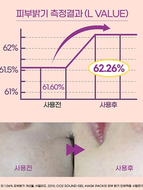 슈혼 구둣주걱 18