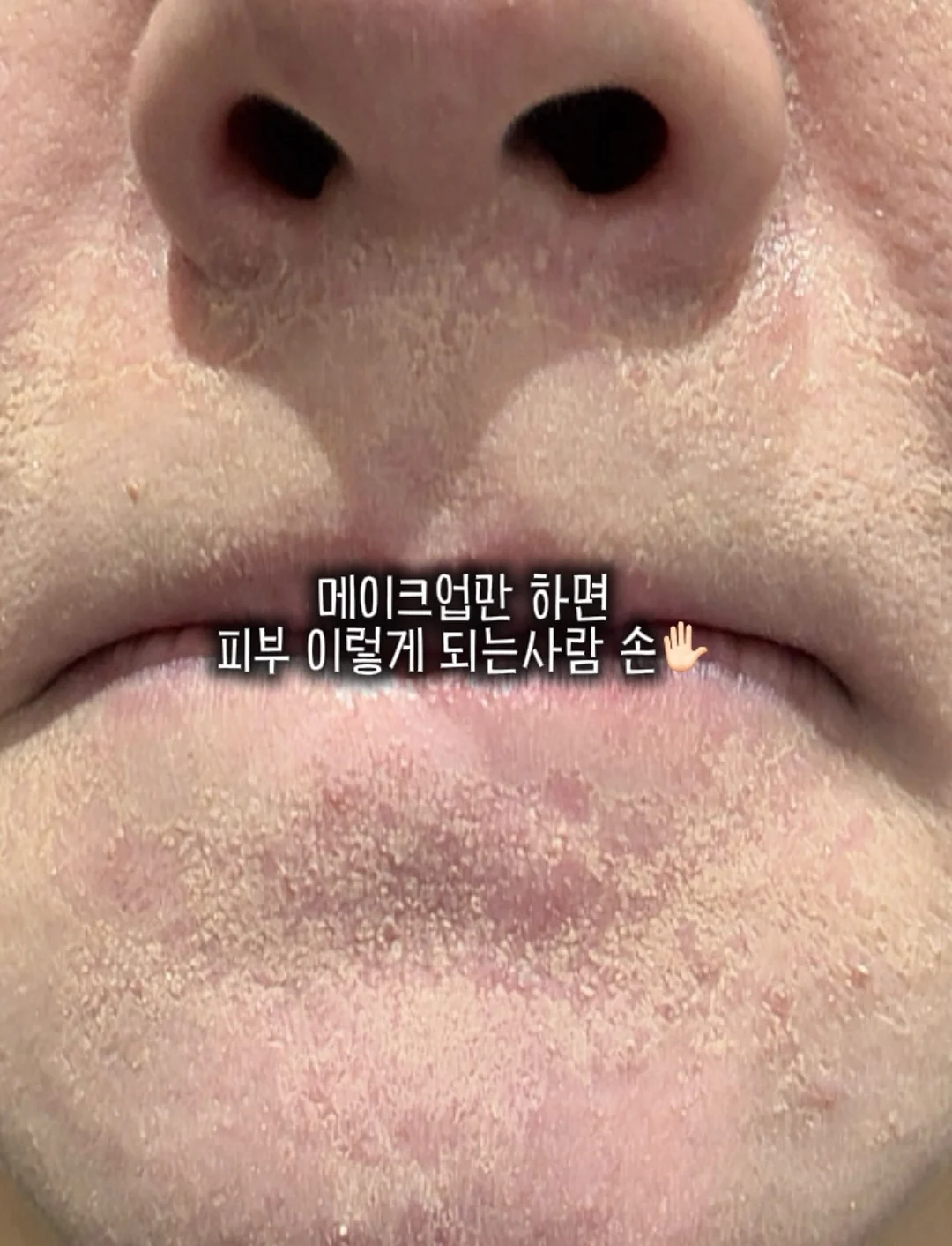 세트룩 1