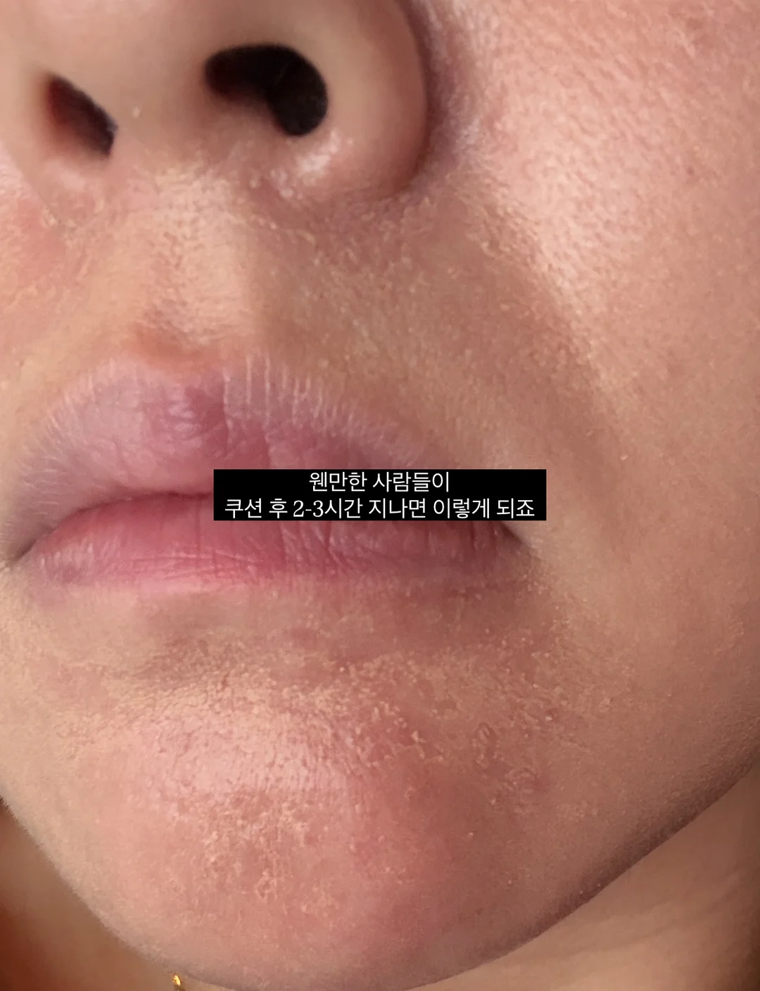세트룩 2