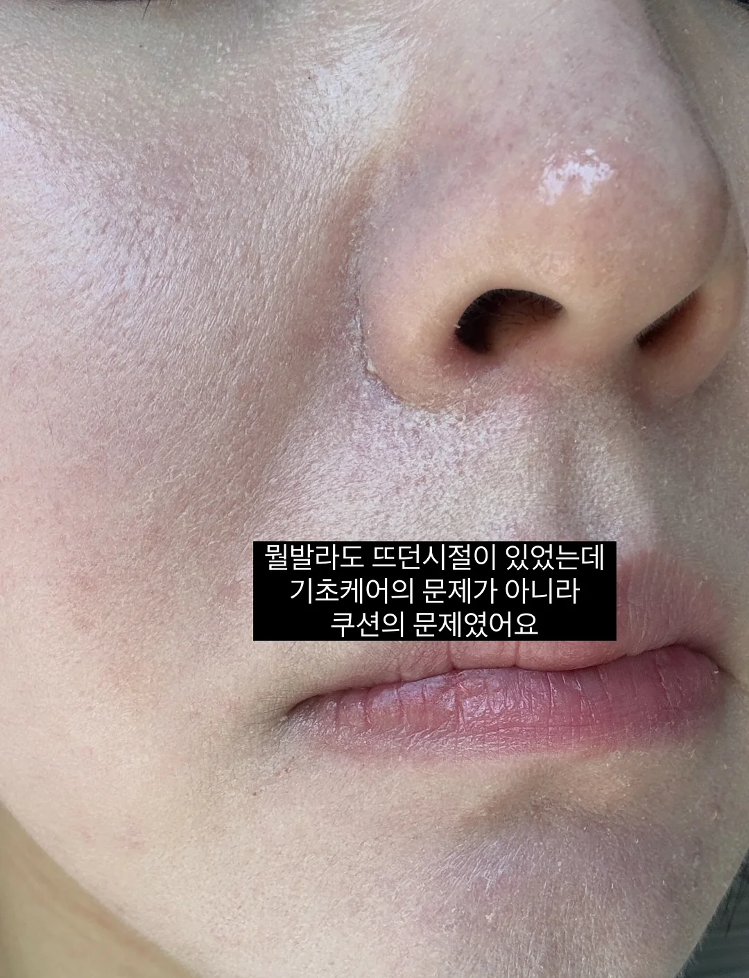 세트룩 6