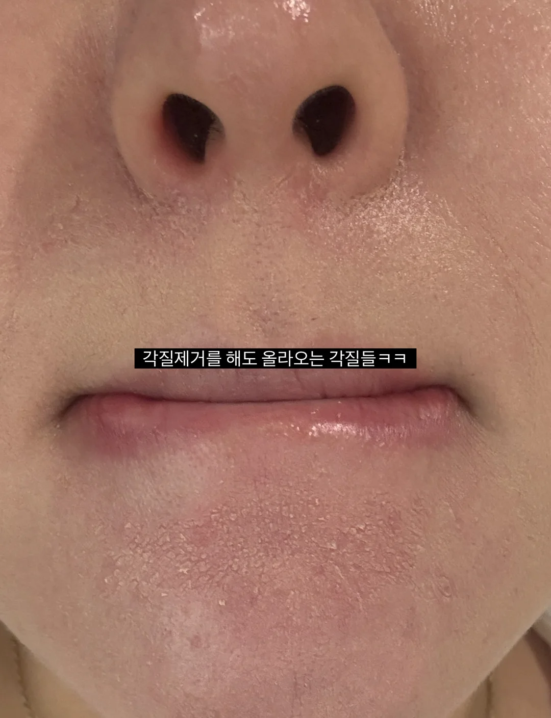 세트룩 7