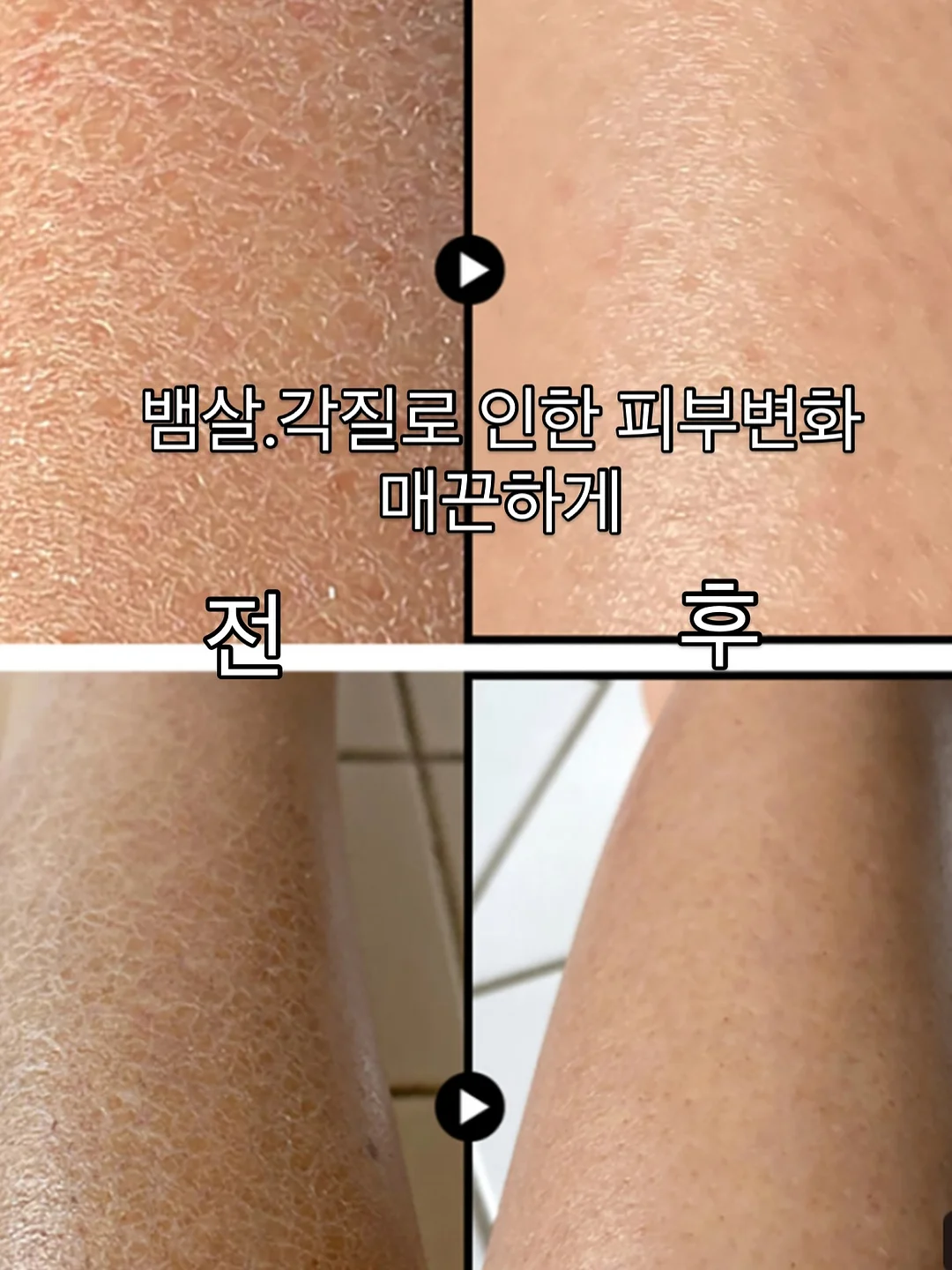물놀이 캐치볼 세트 10
