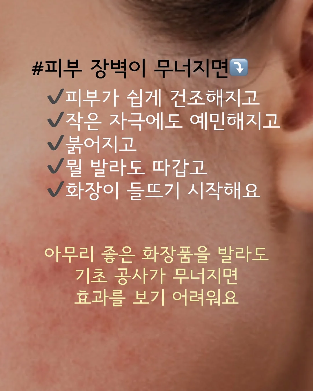 모기밴드 3