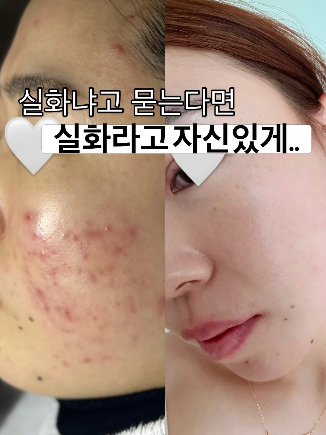 노까짐 플랫 슈즈 3