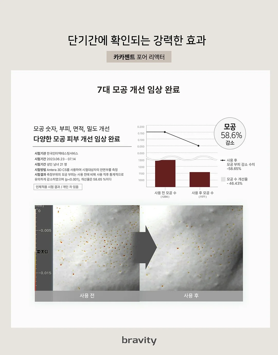 레고 7