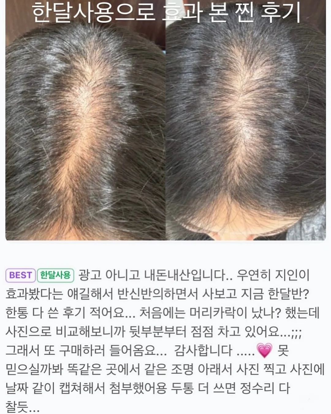 아기 외출 준비 9