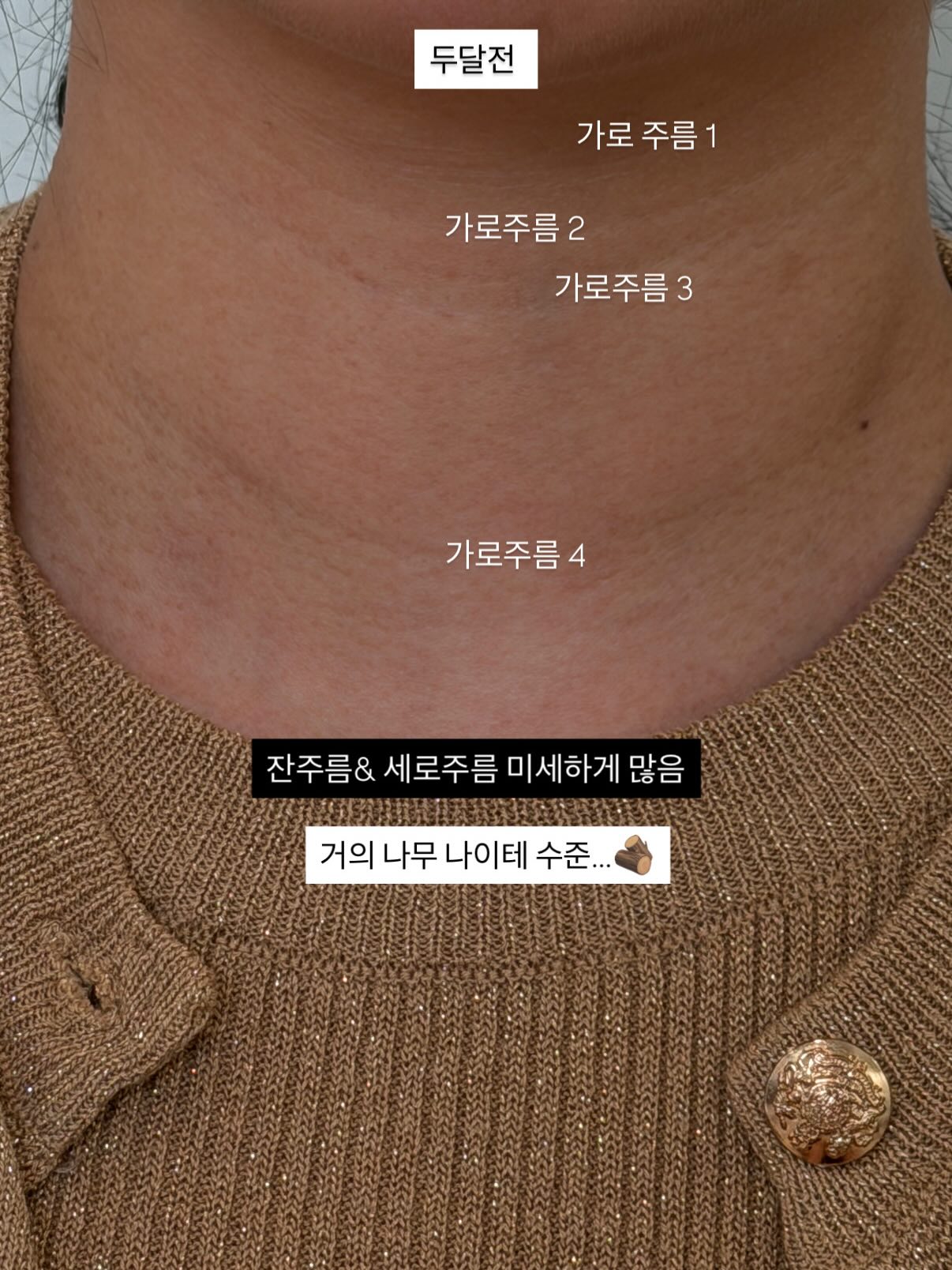 베어비 누브라 9