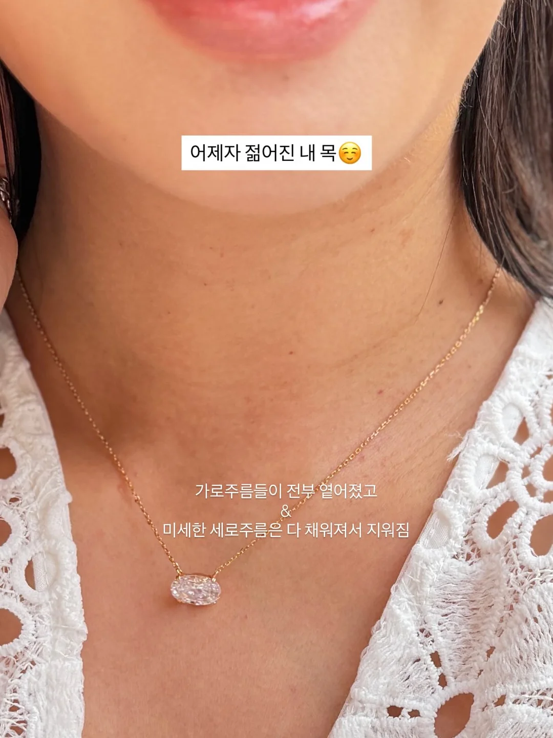 베어비 누브라 10