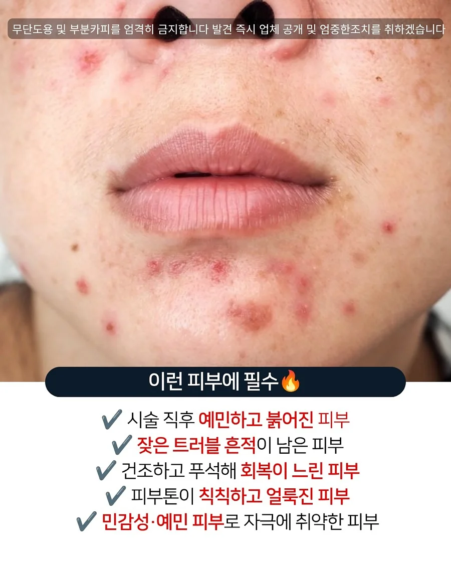 버블 네일 스티커 8