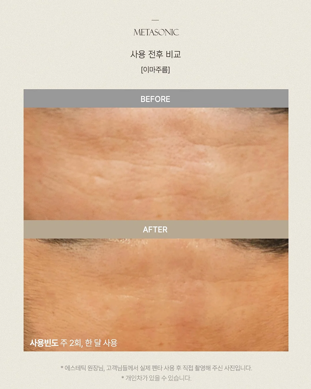 돌쇠네 농산물 생새우 13