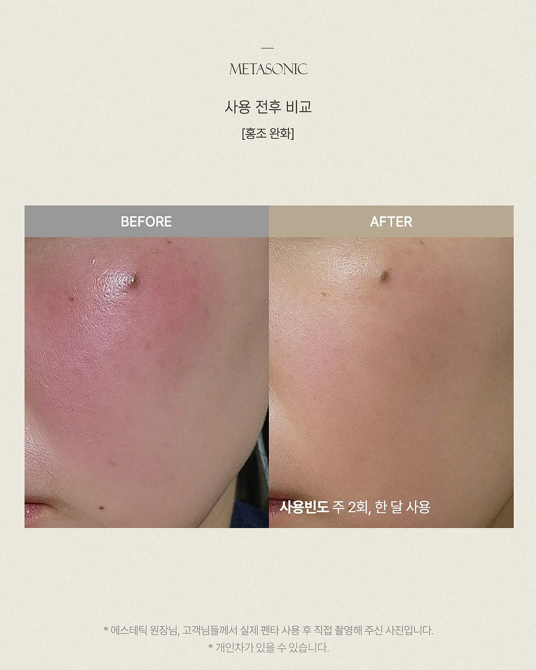 돌쇠네 농산물 생새우 14