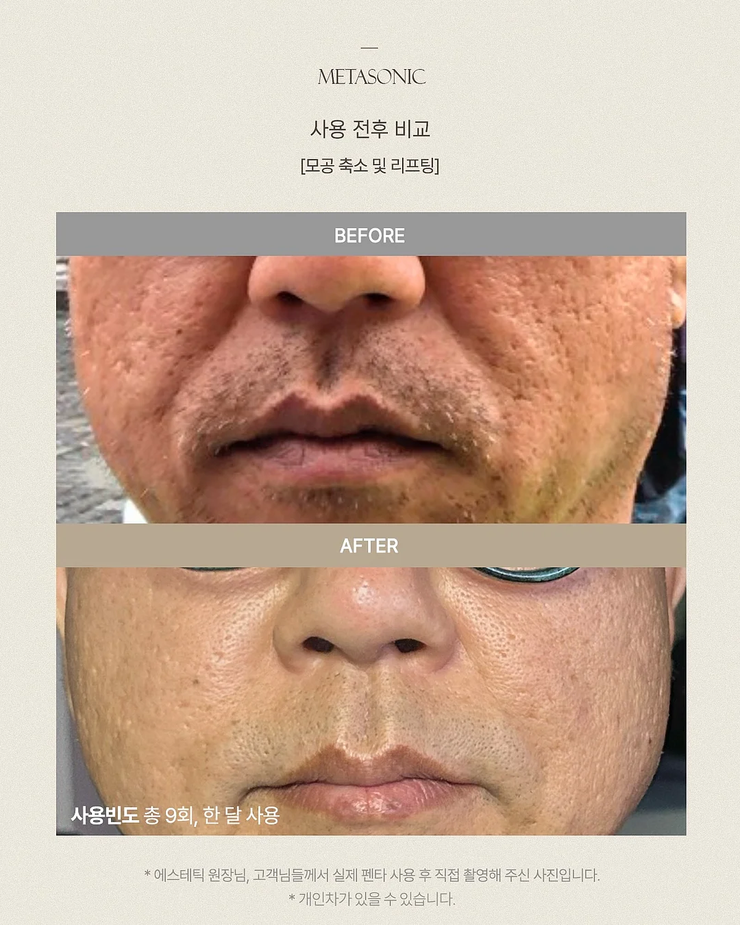 돌쇠네 농산물 생새우 15