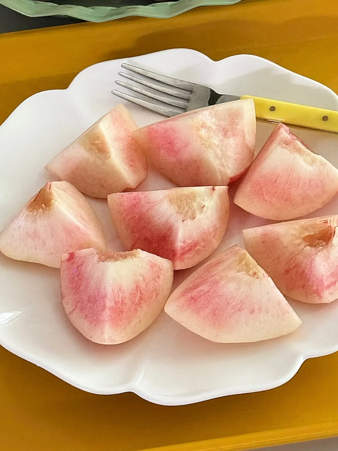 눈밑지방 정보 13