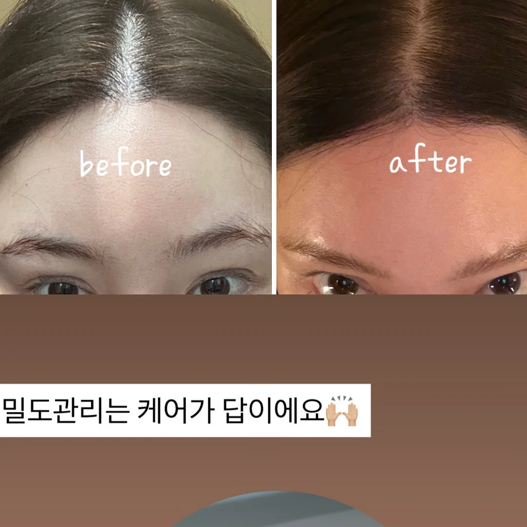 감식초 20병 7