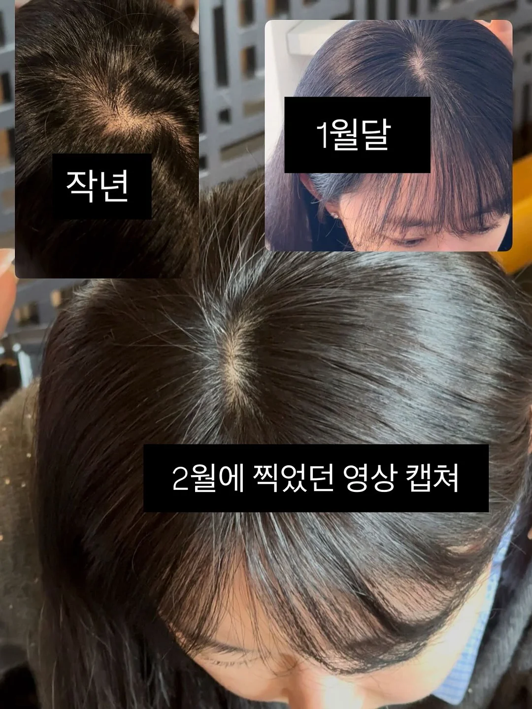 슈퍼세이브 곰보배추시럽 2