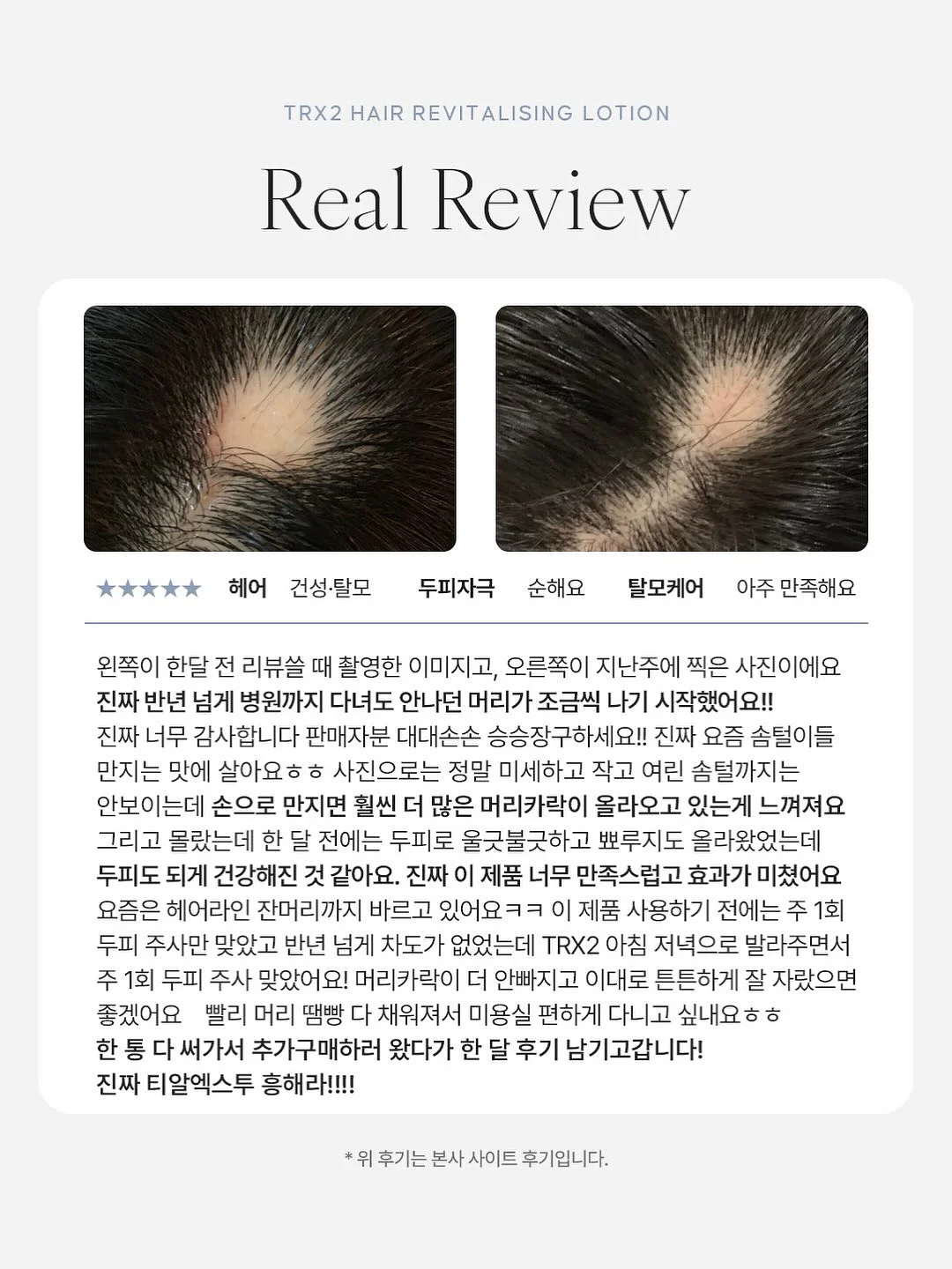 슈퍼세이브 곰보배추시럽 4