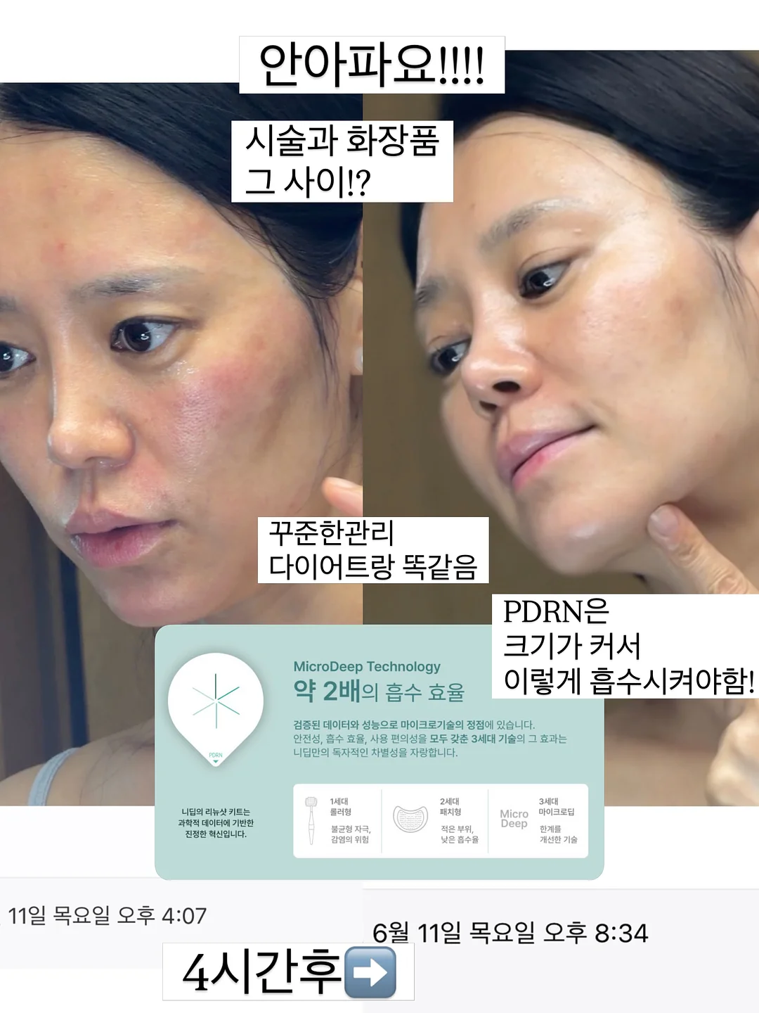 하트 자수 누빔 원단 16