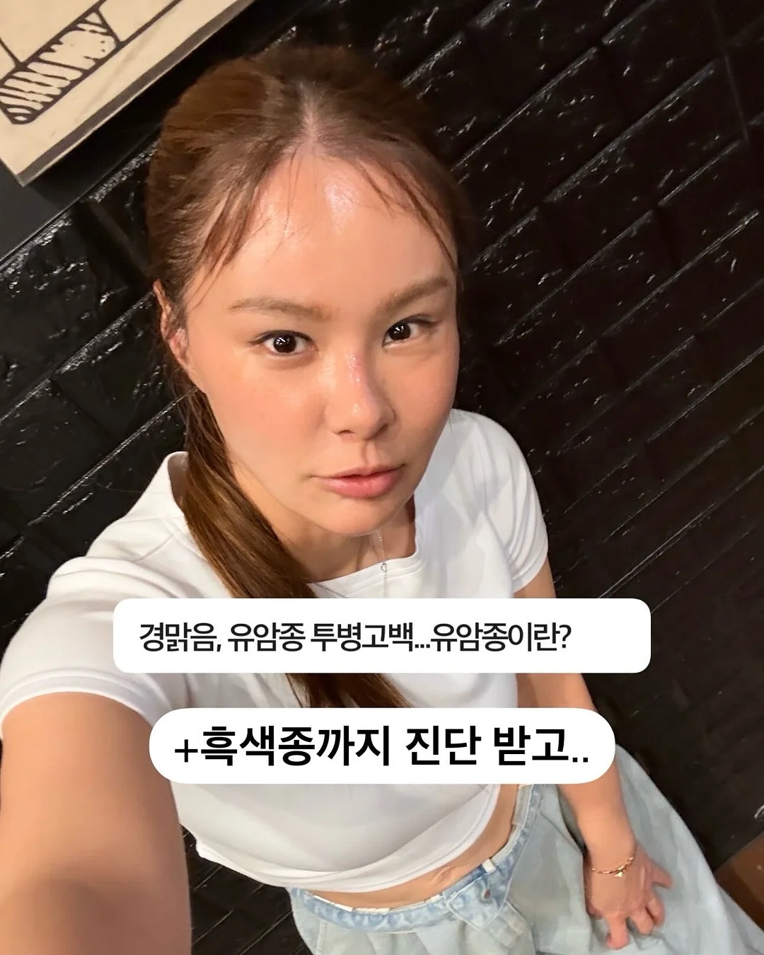지방분해앰플 1