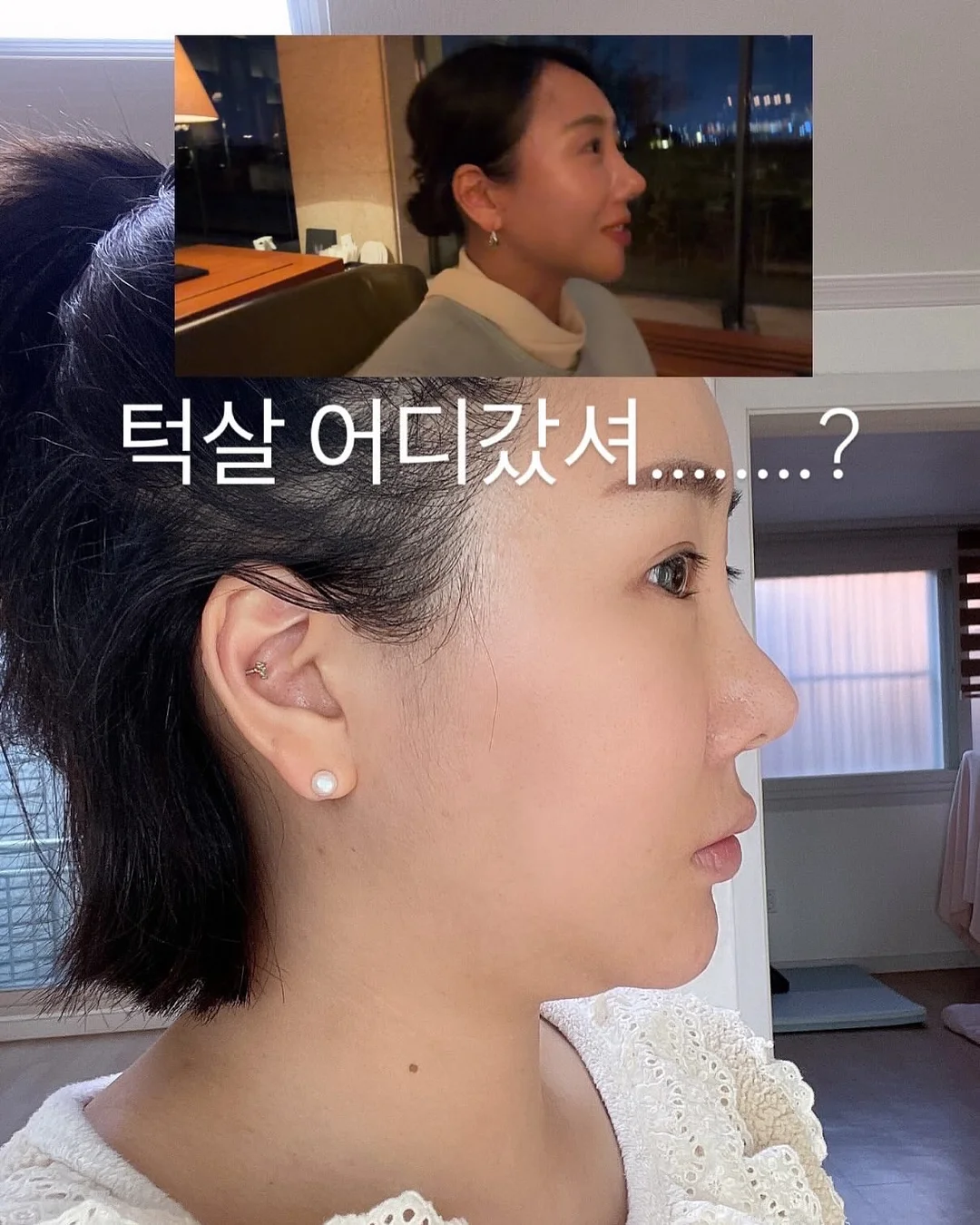 짭짤이 토마토 5