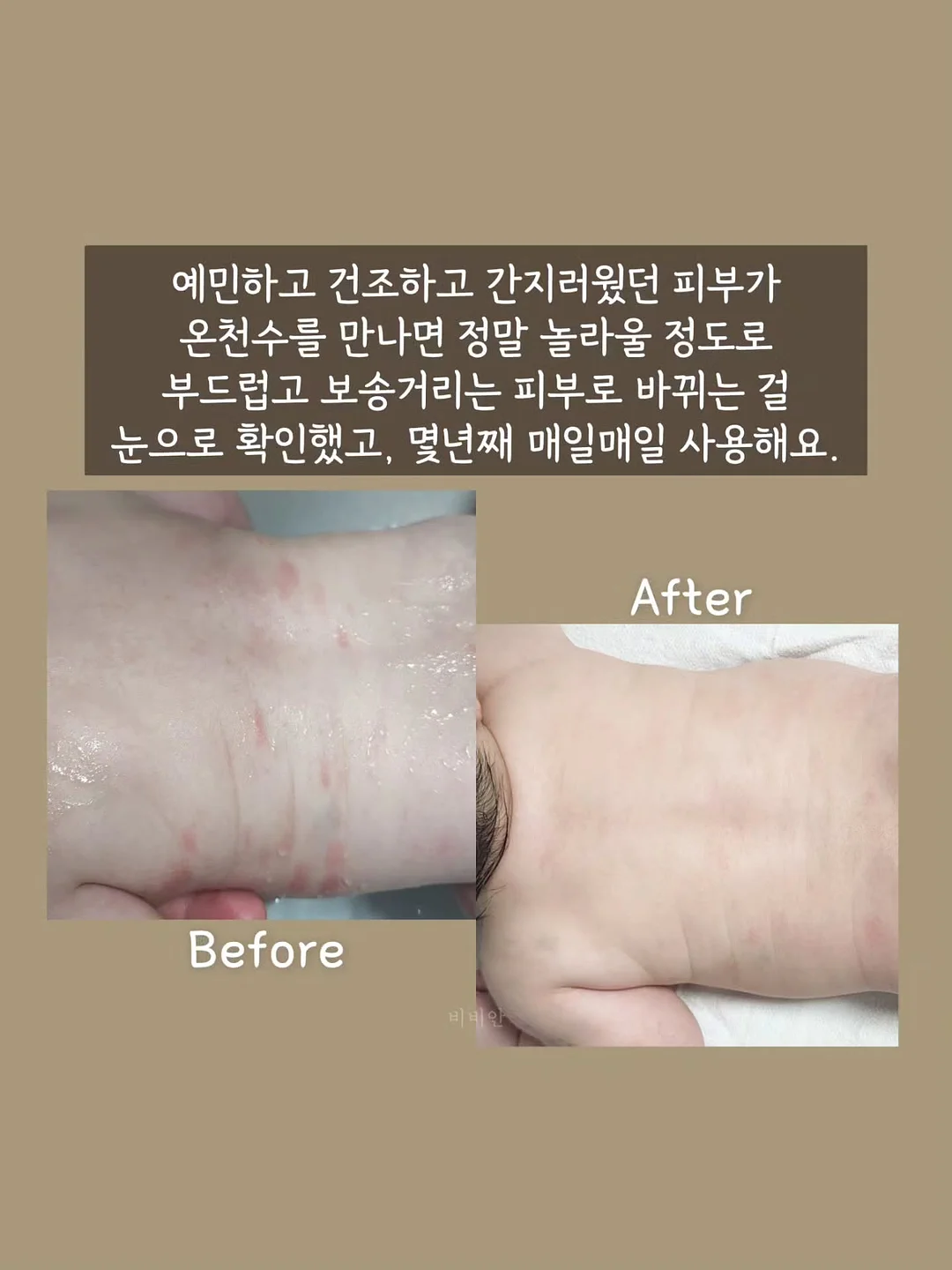 미스트형 에센스 3