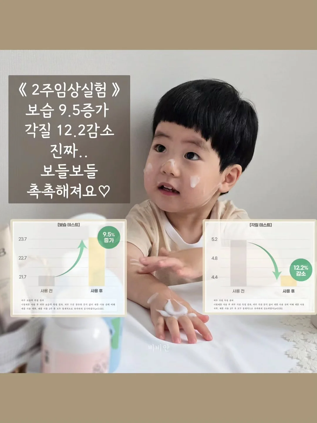 미스트형 에센스 5