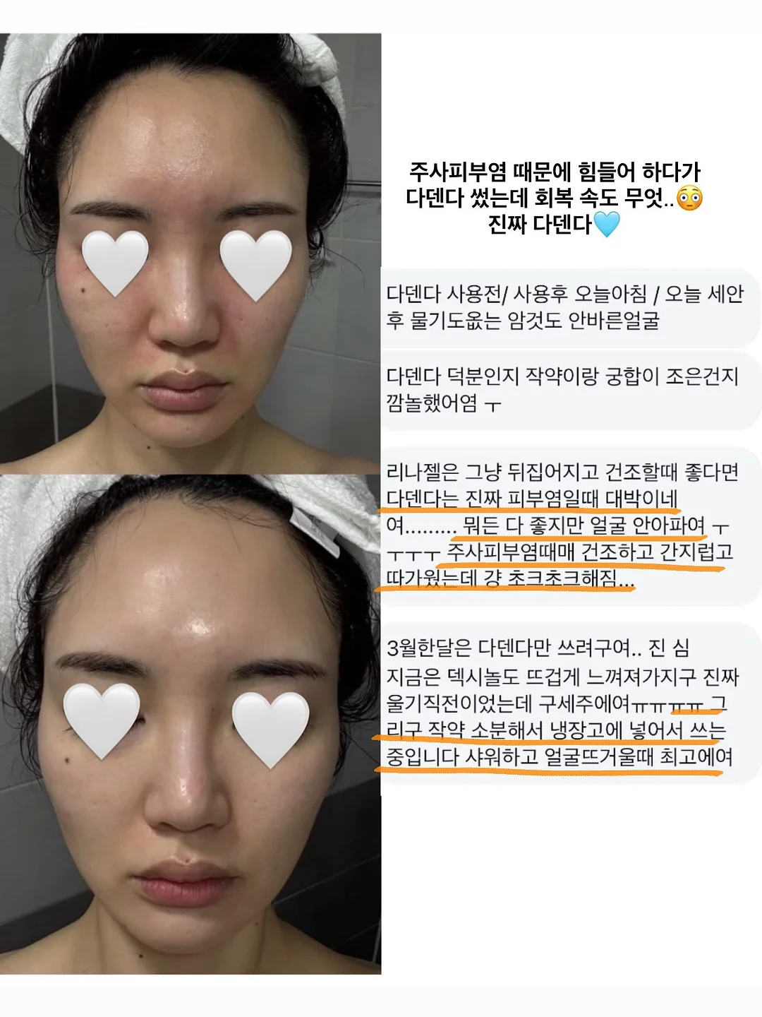 먼작귀 안경거치대 5