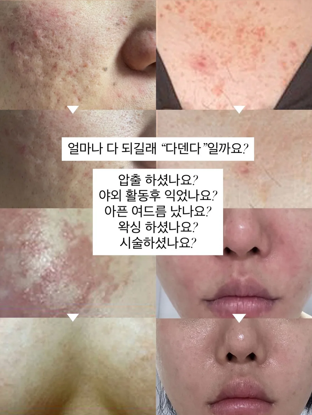 먼작귀 안경거치대 6