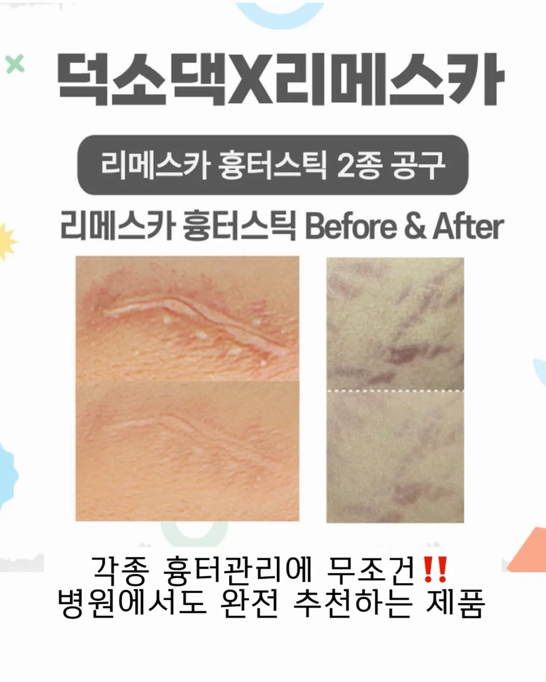 엠락틴 7