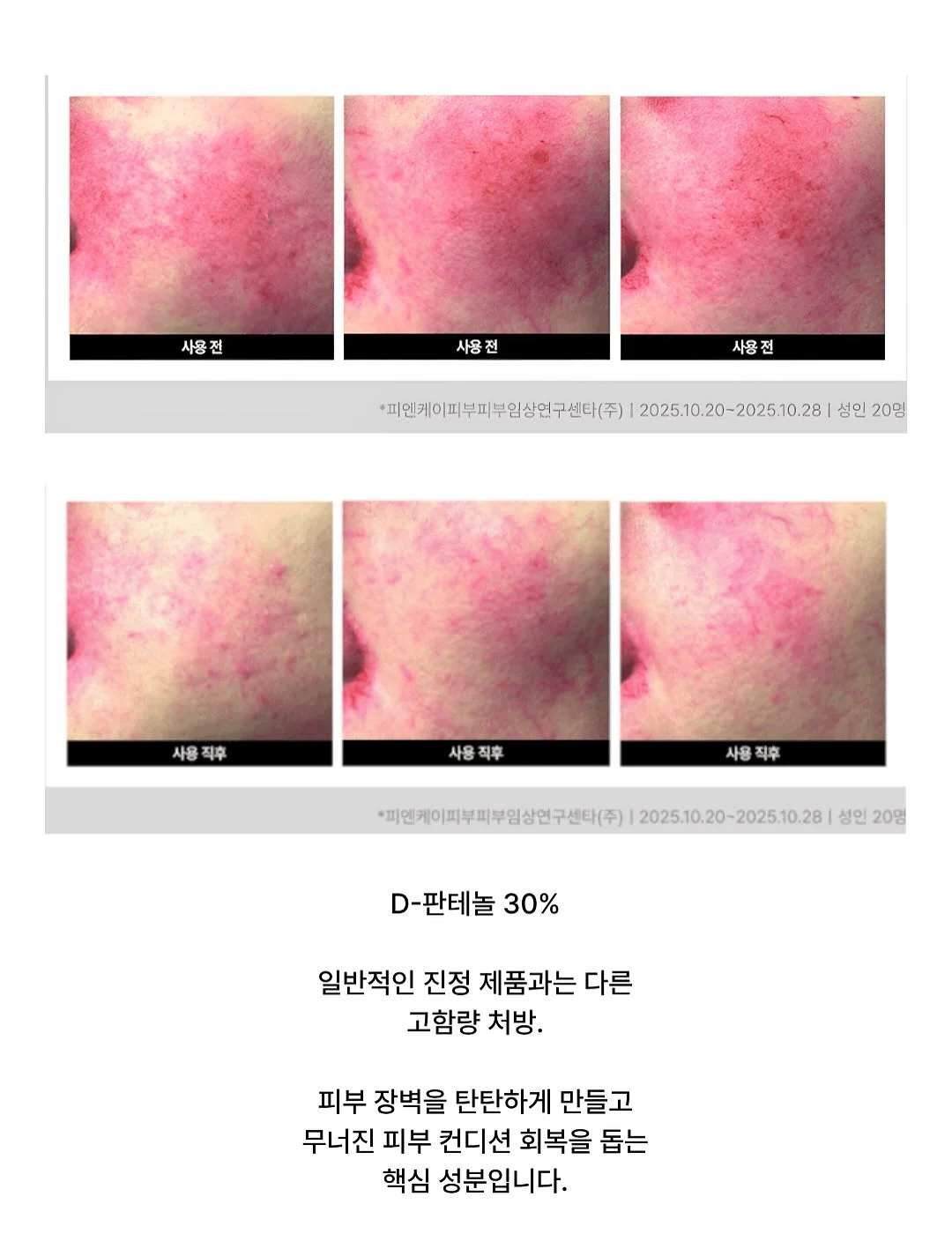 나일론 와이드 밴딩 팬츠 9