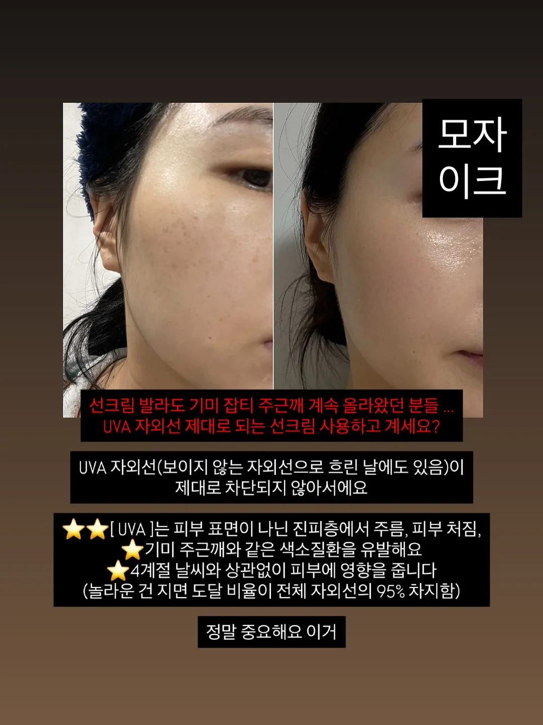 짜지마앰플+A5 메디크림 3