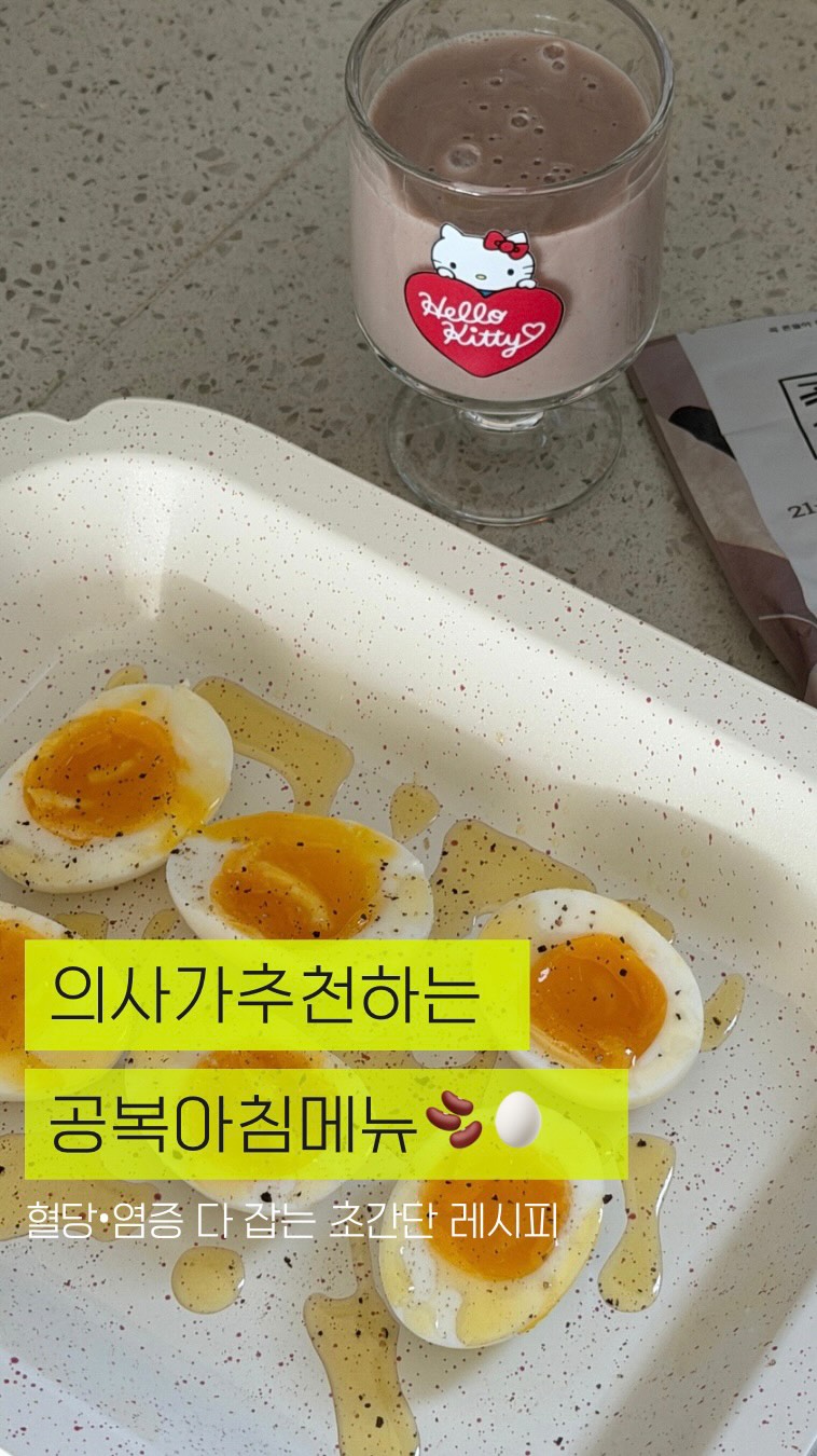 레이스 롱 스커트