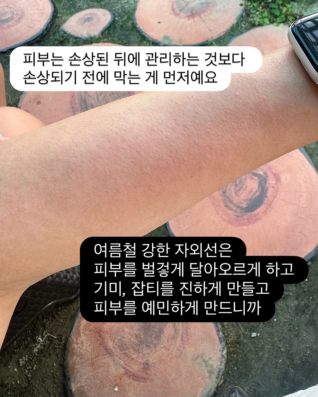 거즈 손수건 5