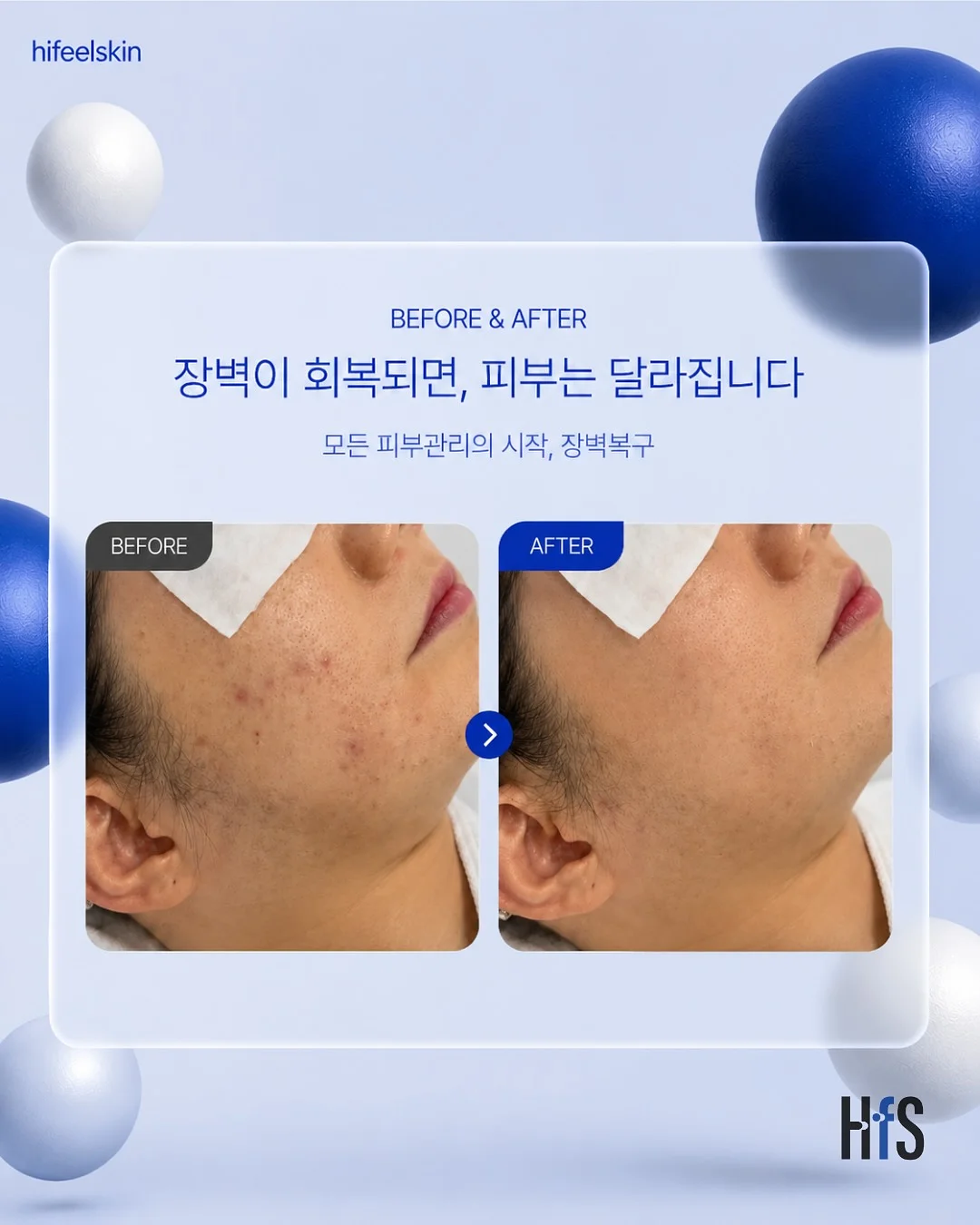매든 에어쿨링 라이트웨이트 팬츠 2